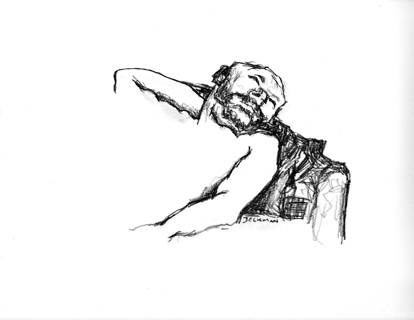 Figure #11